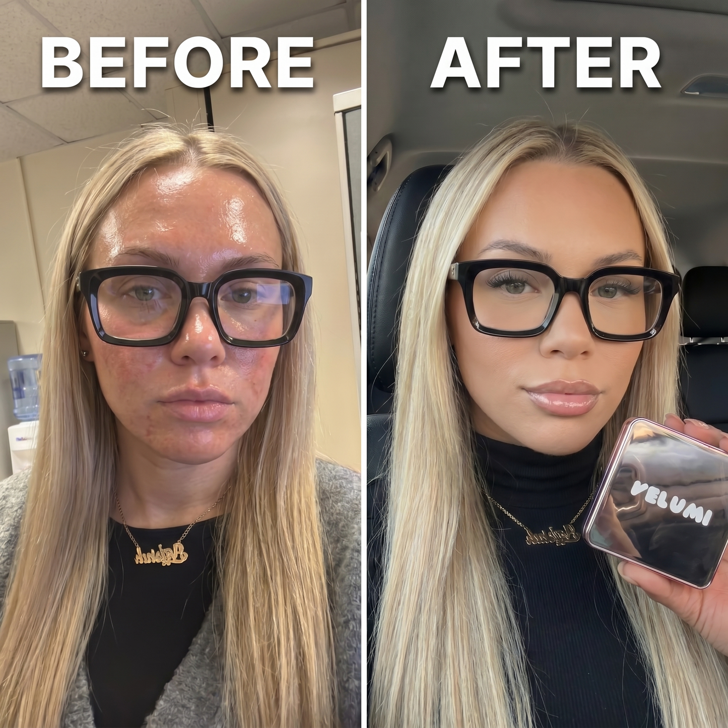 Velumi Undetectable™